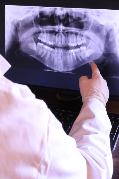 Best Emergency Dentist for Lost Fillings or Crowns in Green Hill, TN