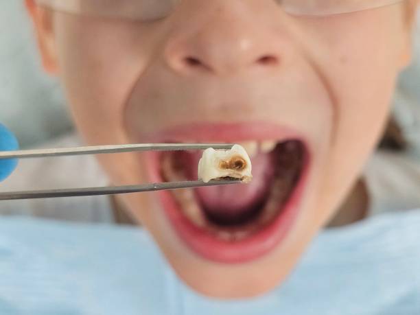 Best Mobile Emergency Dentist in Green Hill, TN