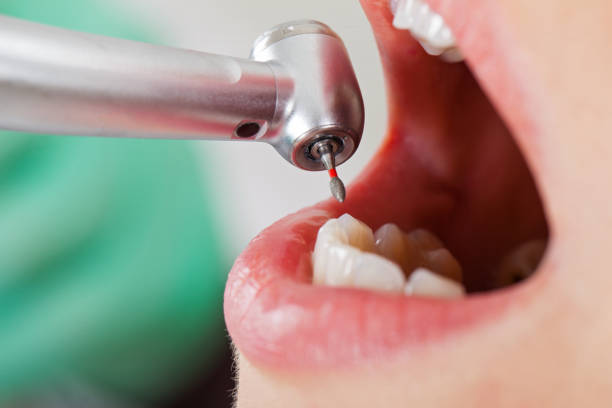 Best Weekend Emergency Dentist in Green Hill, TN